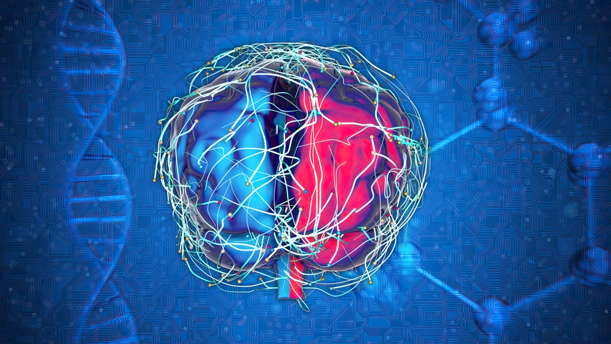 Brain AVM Embolization