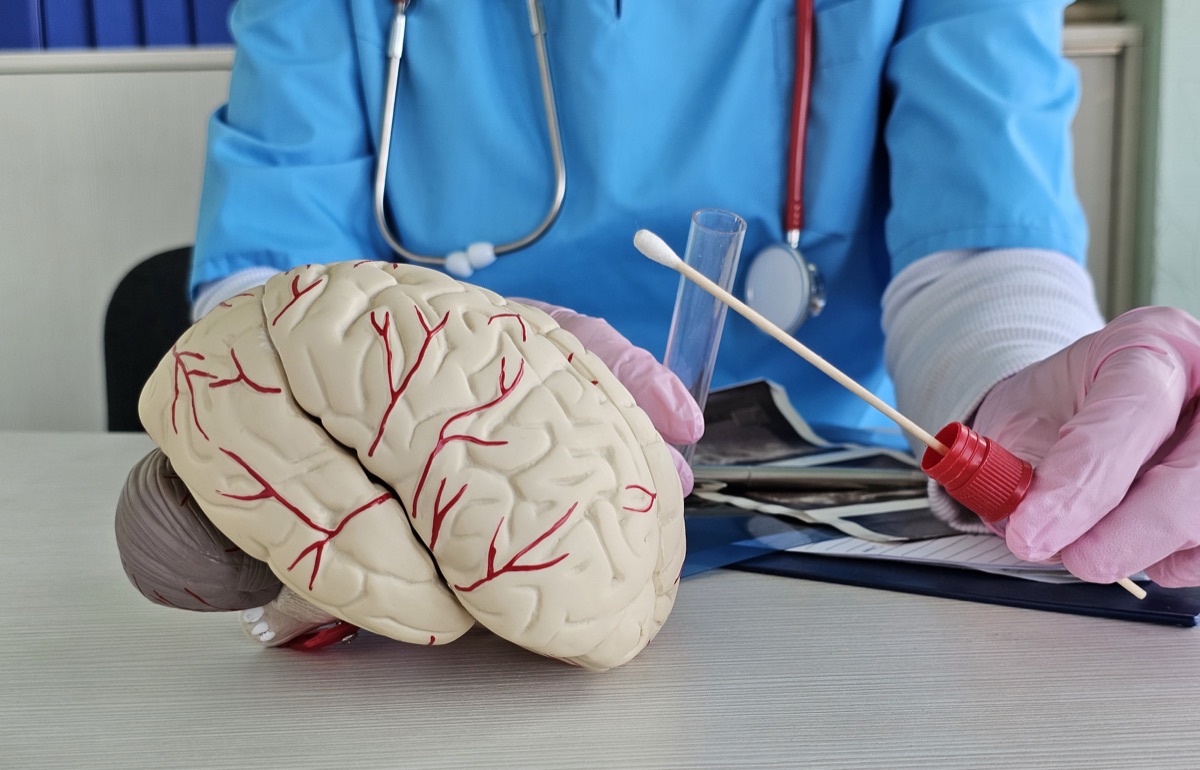 Mechanical Thrombectomy